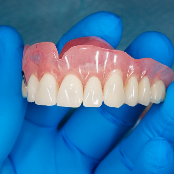 Dental professional holding a full upper denture