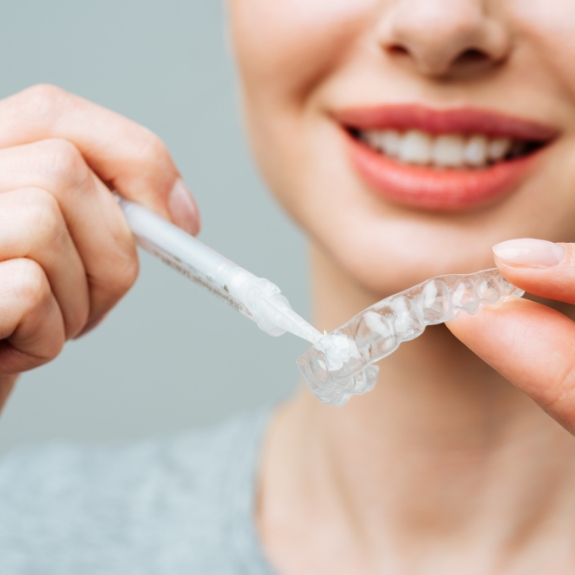Woman placing whitening gel into a teeth whitening tray