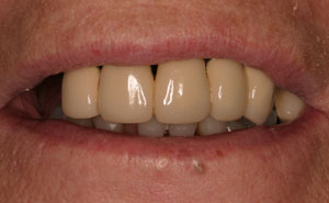 restorative dentistry bellmore