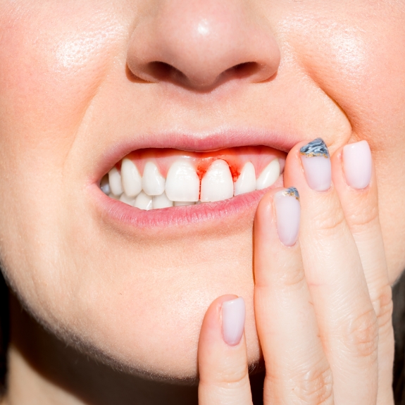 Close up of a woman with red gums holding her cheek in pain