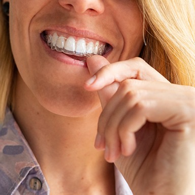 woman putting in Invisalign tray 